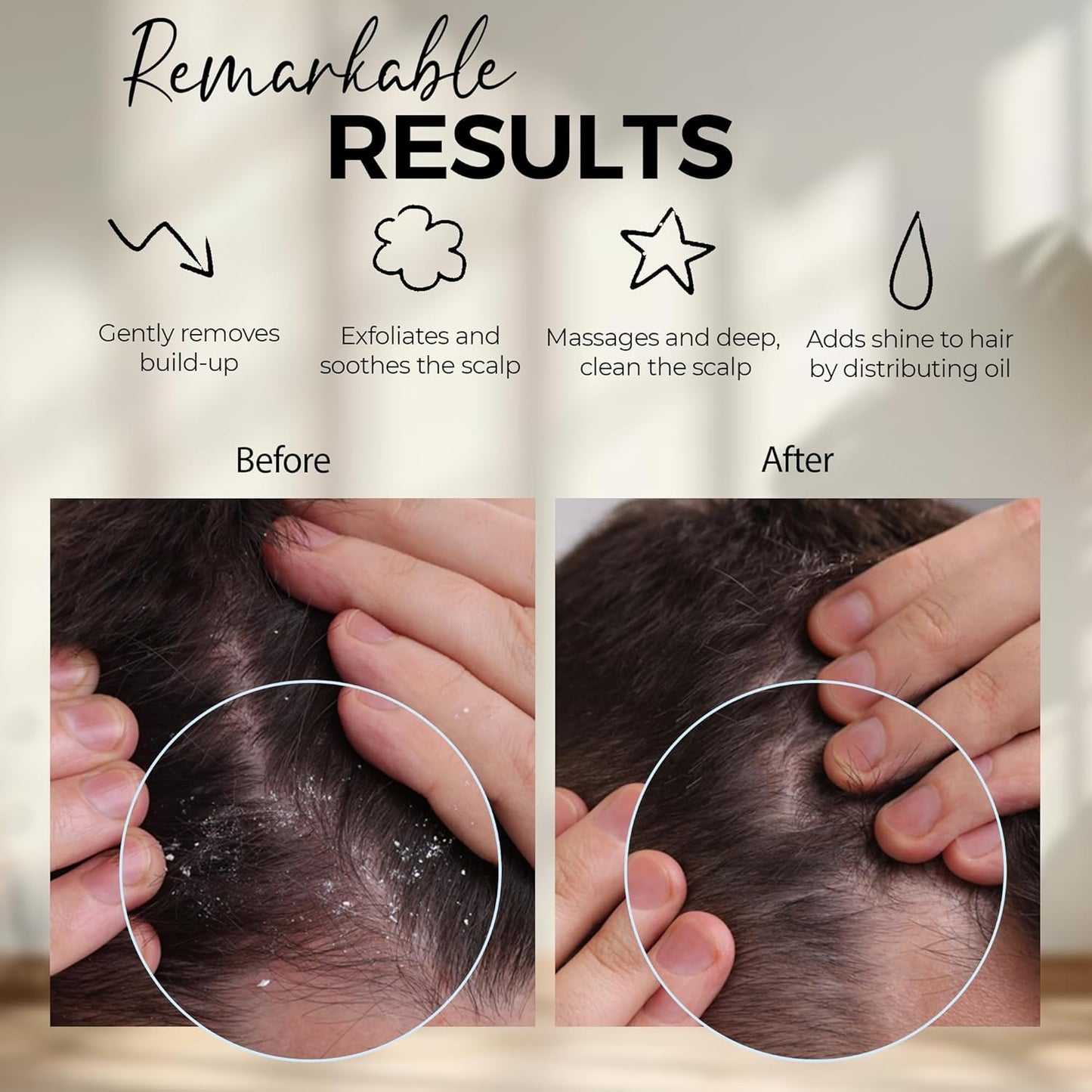 Silicone Scalp Scrubber for Healthy Hair Growth